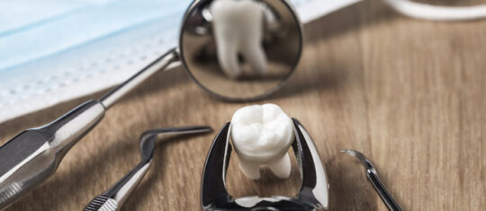 Extraction des dents de sagesse